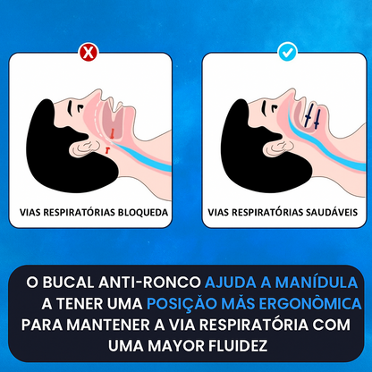 AirRest™ 2025 | Bucal anti-roncos e anti-apneia | Em Promoção